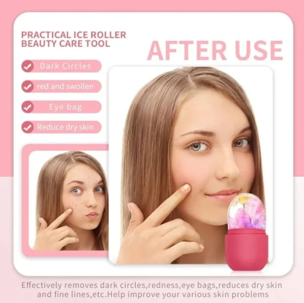 Silicone Ice Roller